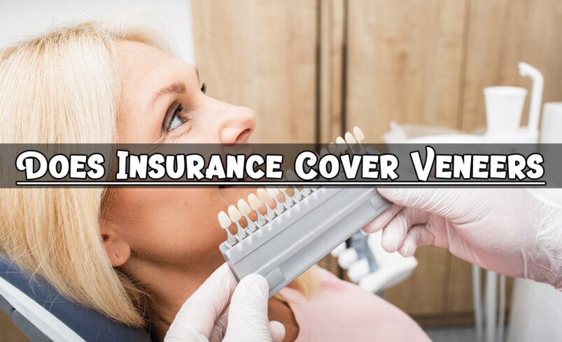 Does Insurance Cover Veneers