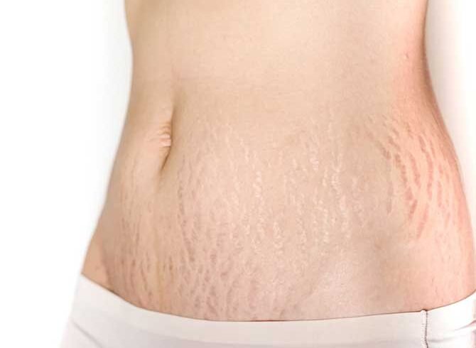 New Mom in Yerevan? Best Products That Are Gentle Enough for Postpartum Skin