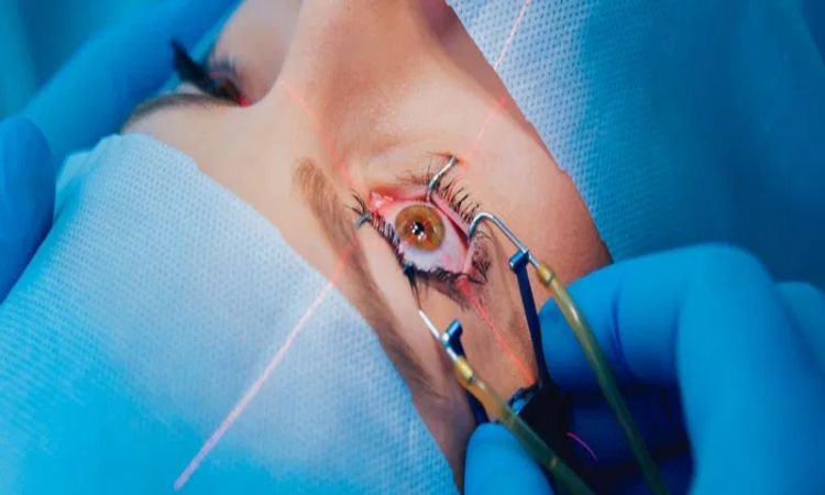 LASIK Eye Surgery Recovery