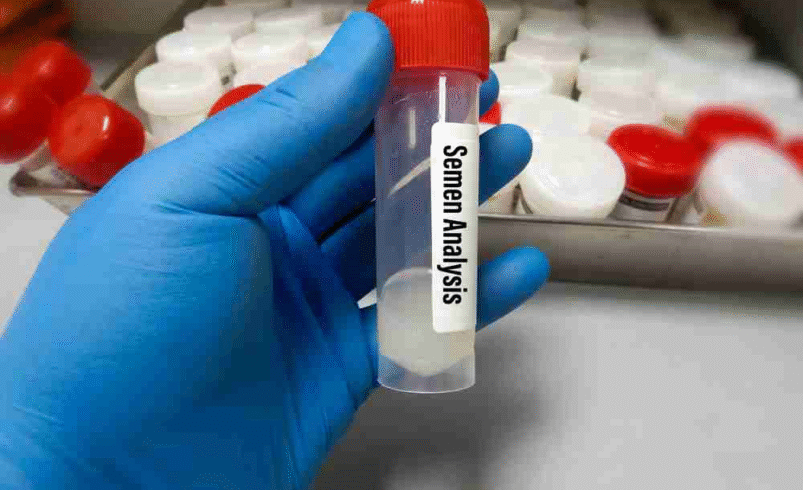 Testicular Ultrasound & Sperm Count Test: What Every Man Should Know