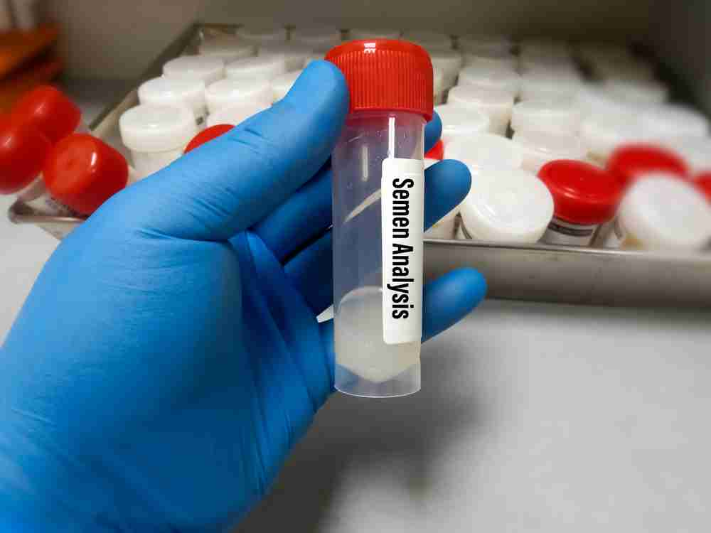 Sperm Count Test